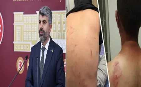 HÜDA PAR’lı Dinç’ten Mersin’deki ırkçı saldırıya tepki: 'Nefret söylemi soruşturulmalı'