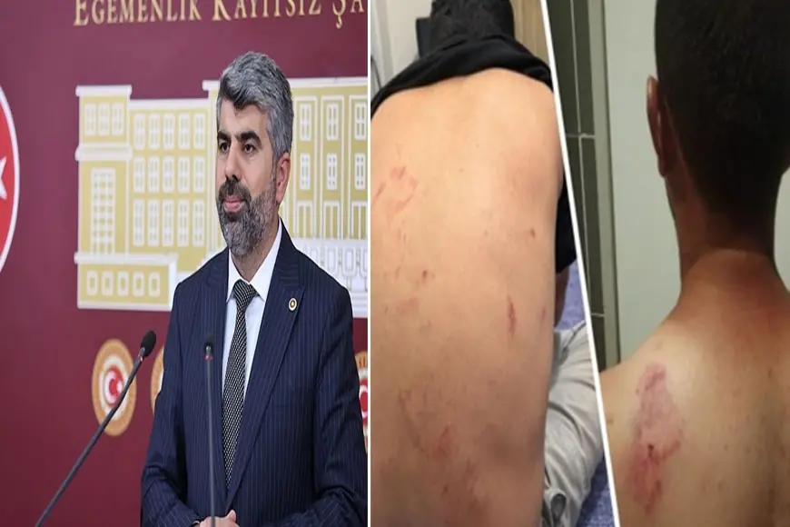 HÜDA PAR’lı Dinç’ten Mersin’deki ırkçı saldırıya tepki: 'Nefret söylemi soruşturulmalı'