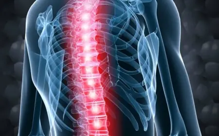 'Dünyanın İlk Omurilik Nakli, Hastaların Yeniden Yürüme Umudu Olabilir'