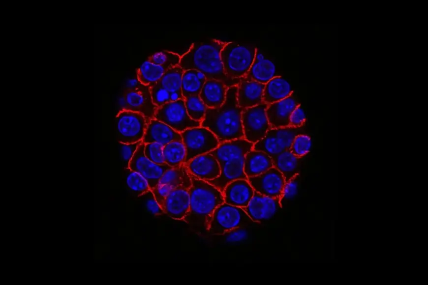 'Sessiz katil'e karşı yeni umut: Mekanizma bozulunca tümörler küçüldü