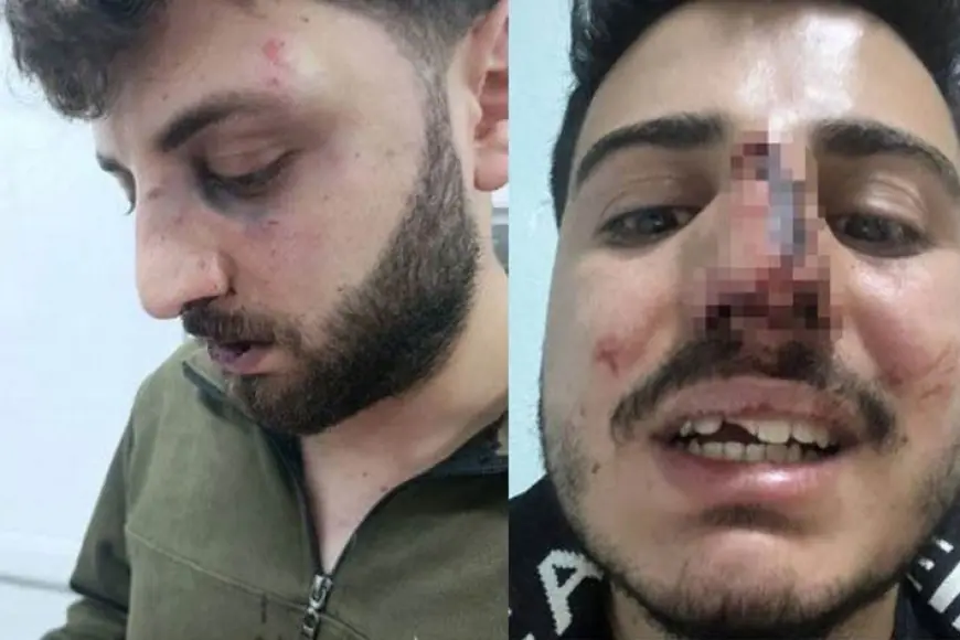 Van'de ‘3 gence polis darp’ iddiası: Soruşturma başlatıldı