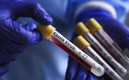 İsrail'de ilk kez görüldü: Bir kişi Ebola şüphesiyle karantinaya alındı