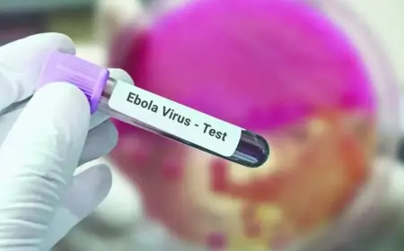 Fransa'da Ebola vakası görüldü