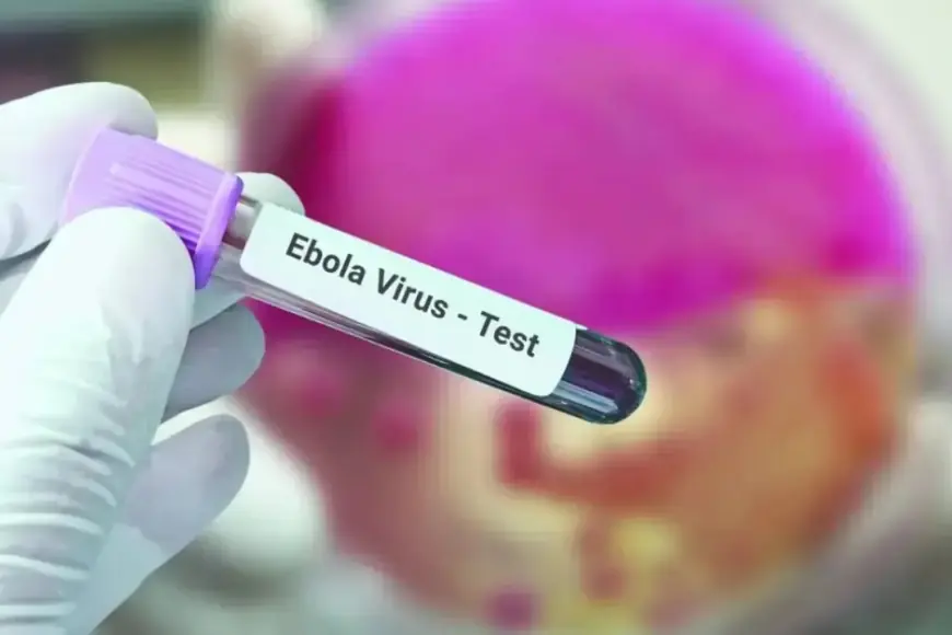 Fransa'da Ebola vakası görüldü