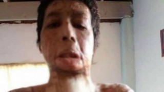 Zilamekî bi petrolê hevjîna xwe şewitand