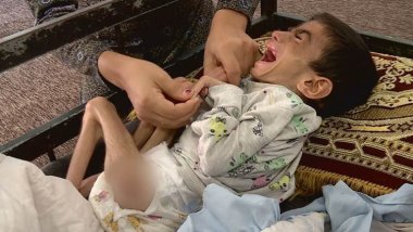 Zêrîna biçûk a ji Kobaniyê ji ber şaşîtiyeke bijîşkî felc bû