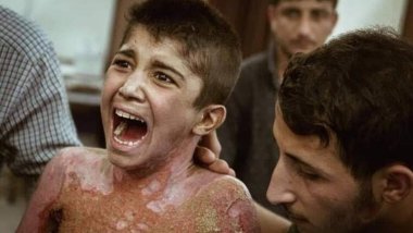 Mihemedê Serê Kaniyê: Ez ne Filistînî me û ez li Serê Kaniyê birîndar bûm