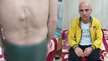 Fînlendayê Kurdekî nexweş dersînor kir: Hestiyên wî şikestî ne