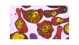 İklimin ısınması yüzünden sıtma 'yükseklere tırmanıyor'