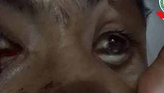 IŞİD Kobani’de zehirli gaz kullanıyor.