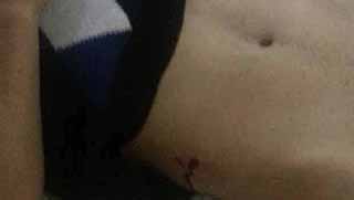 Diyarbakır'da polis şiddeti