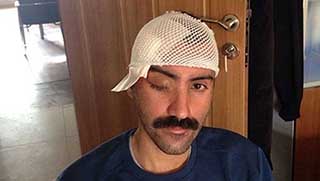 Bir annenin dramı: Oğlumun gözü için...