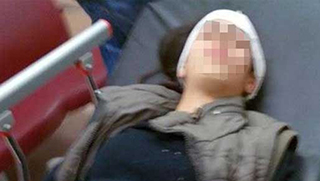 Polis 14 yaşındakı çocuğu başından vurdu