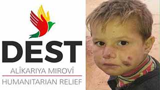 Kobanêlilerin yeni düşmanı: Şark çıbanı