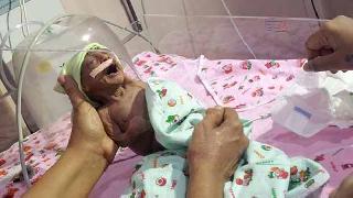 Bir bebek sırf çirkin olduğu için terkedildi