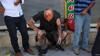 Suruç Devlet Hastanesi'ndeki yaralıların isimleri