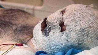 HDP  bayrağını yakıp, aracın içine attı