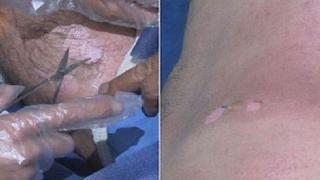 ABD'den açıklama: IŞİD peşmergeleri hardal ile vurdu