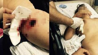 Keskin nişancılar Cizre'de bir çocuğu vurdu