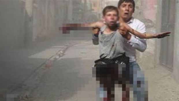 Cizre'deki patlamada elini ve ayağını kaybeden Yusuf: Ben nasıl kalem tutacağım?