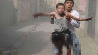 Cizre'deki patlamada elini ve ayağını kaybeden Yusuf: Ben nasıl kalem tutacağım?