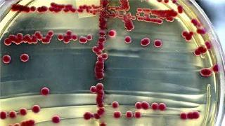 Uzmanlardan Uyarı: Antibiyotik Kıyametin Eşiğindeyiz