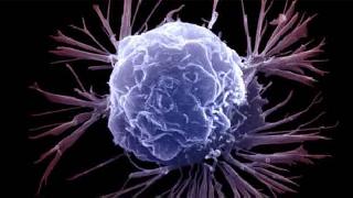 Kanserin 'zayıf noktası bulundu'