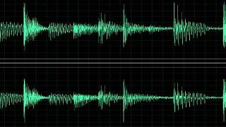 HDP'li Vekillere ses analizi yapılacak