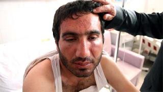 Alında bot izi çıkaran polis dayağına yıllar sonra Yargıtay ayarı 