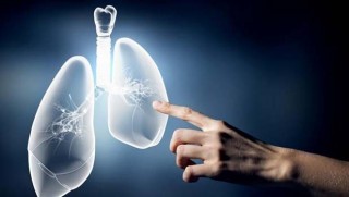 Akciğer kanseri için yeni bir tedavi daha