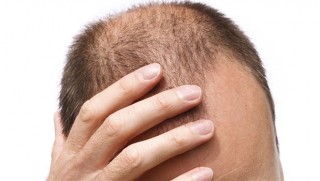 Polis Alarmda! Ülkede kelleri tek tek öldürüyorlar