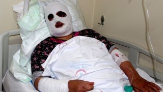 Ağrı'da lavabo açıcıya sıcak su döken kadının yüzü yandı