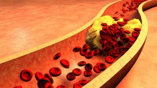 Damar tıkanıklıklarını 'yok eden' ilaç bulundu