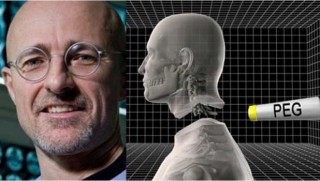 İlk kafa nakli... Kadavra üzerindeki deney başarılı!