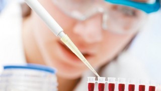 Tümörün izini silen buluş