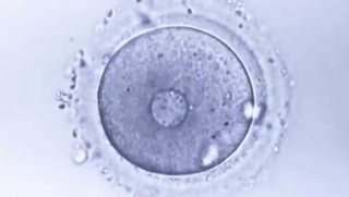 Laboratuvar ortamında ilk kez insan yumurtası geliştirildi
