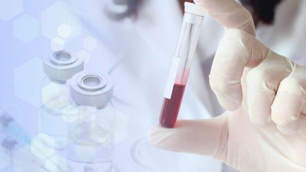 ABD'de geliştirilen yeni kan testi, ömrünüzün ne kadar kaldığını gösterecek!