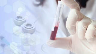 ABD'de geliştirilen yeni kan testi, ömrünüzün ne kadar kaldığını gösterecek! 