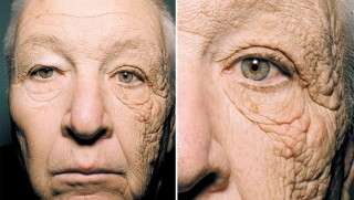 Yüzünün yarısı 20 yıl yaşlandı!