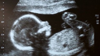 İnsan embriyosunun 'genleri değiştirilebilir'