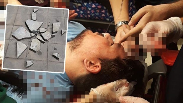 Parke taşlı saldırıya maruz kalan doktor ağır yaralandı