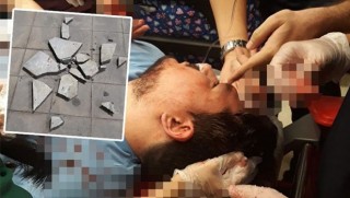 Parke taşlı saldırıya maruz kalan doktor ağır yaralandı