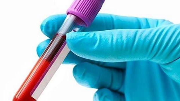 Kanada'da bilim insanları, kanı dönüştüren teknik geliştirdi