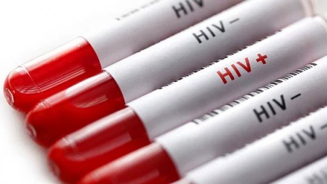 H.I.V. tedavisi görenler için sevindiren haber: Tarihte ikinci defa bir hasta kurtulmuş olabilir