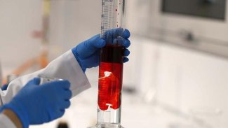 Karaciğer nakli tarihe karışacak...Bilim insanları yeni bir hücre keşfetti!