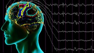 Beyin rahatsızlıkları için implant geliştirildi 