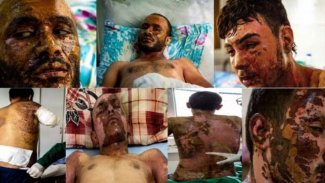 Newsweek: Rojava'da kimyasal silah kullanımı belgelendi