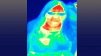 İngiltere'de bir kadın müzedeki termal kameradan meme kanseri olduğunu öğrendi