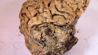 2600 yıllık insan beyni sağlam olarak bulundu