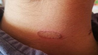 Siirt'te soba ızgarasıyla öğrencilere işkence